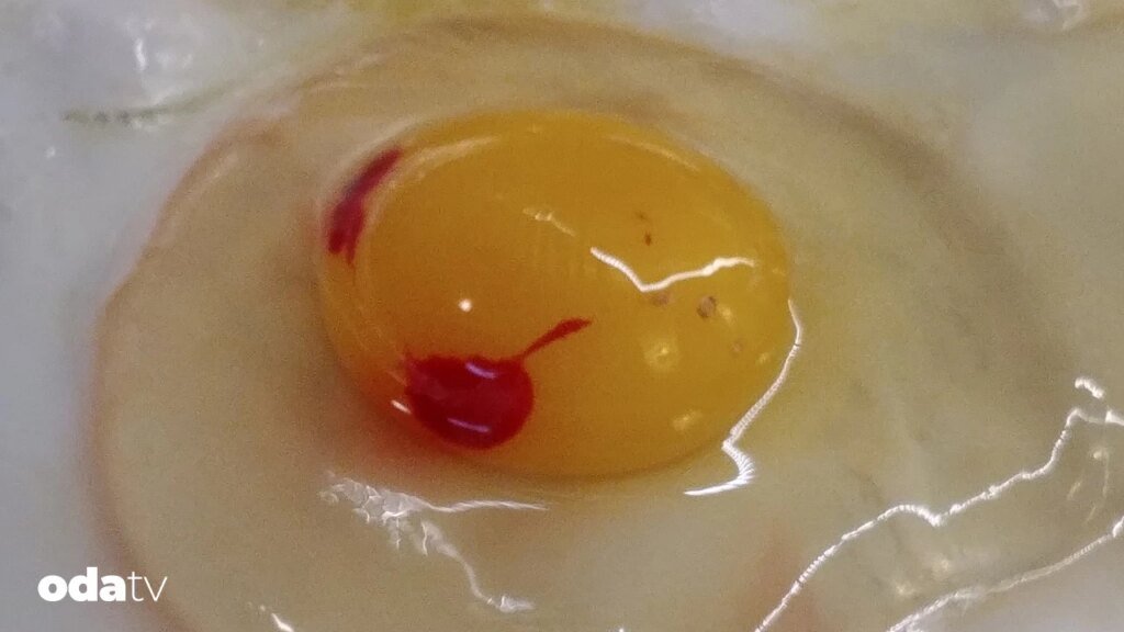 Yumurtada kırmızı leke neden oluşur