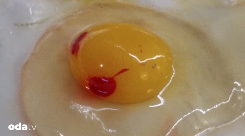 Yumurtada kırmızı leke neden oluşur